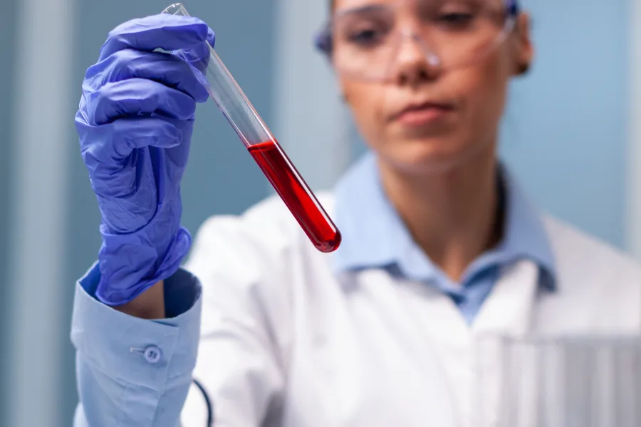 Glomerulopatias e síndromes nefrótica e nefrítica